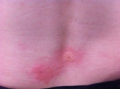 YVD image-81-June 28, 2015